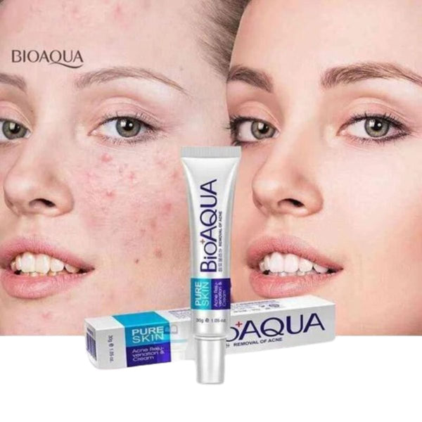 BIOAQUA Anti Acne Cream Acne Scar Removal Cream BQY0719